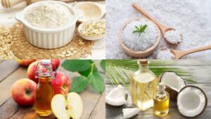 4 Cách trị mụn lưng tại nhà